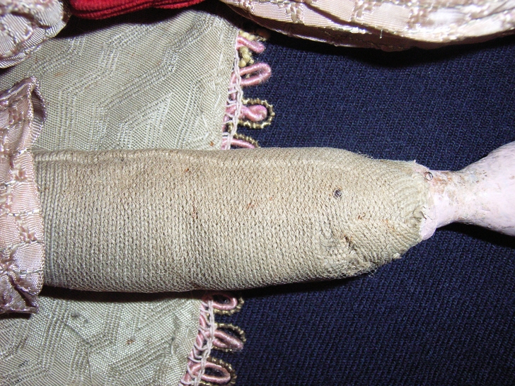 Braccio destro dopo il restauro